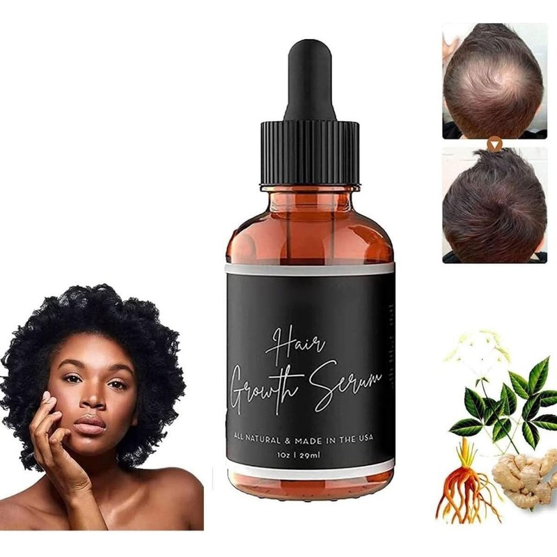 Allurium Hair Growth Serum for Black Women – 29ml (3 Pack) | Fast-Acting Growth & Thicker, Healthier Hair