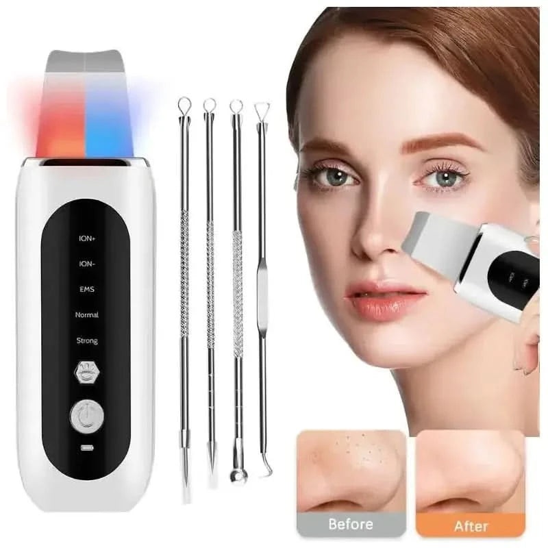 Ultrasonic Face Skin Scrubber | Deep Cleansing, Exfoliating & Serum Booster for Radiant Skin Scrubber Only