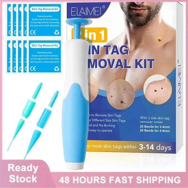 Skin Tag Remover Kit: Effortlessly Remove Skin Tags at Home 01