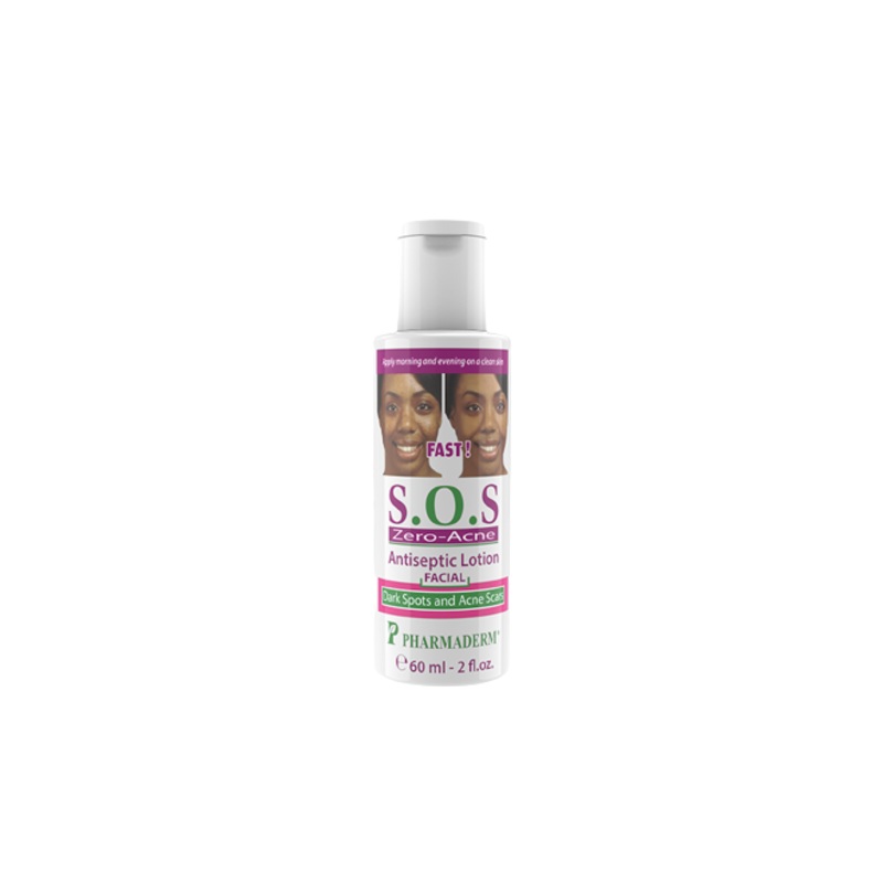 Sos Zero-Acne Antiseptic Lotion
